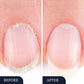 💅 Nagelherstelpen 2+1 GRATIS – herstel, versterk & hydrateer! 🎁✨