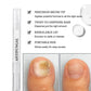 💅 Nagelherstelpen 2+1 GRATIS – herstel, versterk & hydrateer! 🎁✨