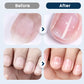 Voedende Nagelherstel Spray