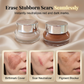 🔥🧴 50% korting! ✨Water- en zweetbestendige concealer die tatoeages bedekt